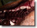 Stomatologie - zubn vpln